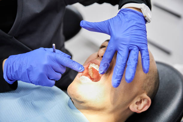 Best Emergency Root Canal Treatment in Columbus, MT